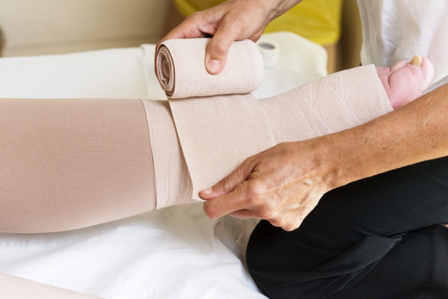 Swollen arm or leg after cancer treatment