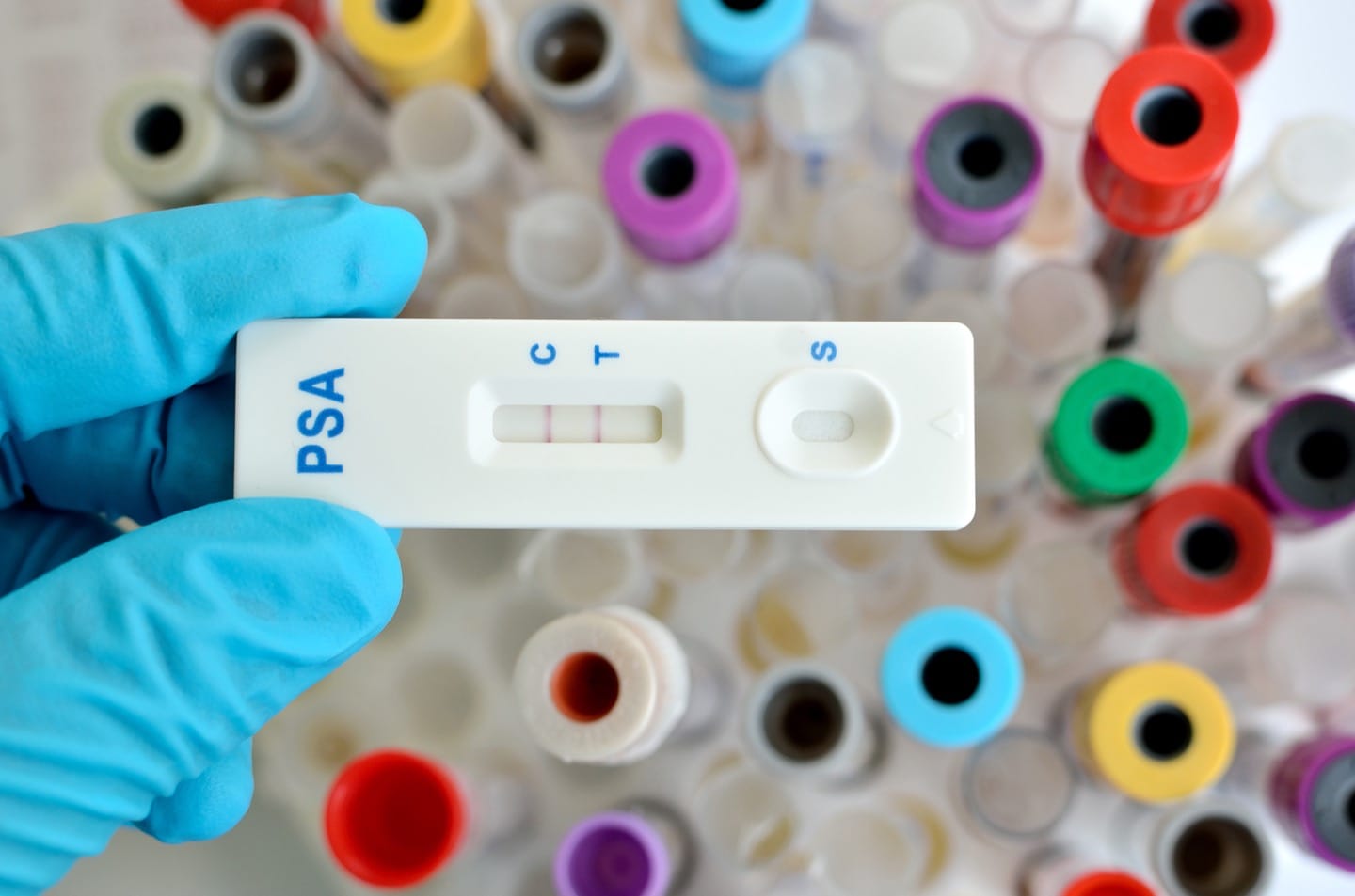 Faulty bowel cancer tests