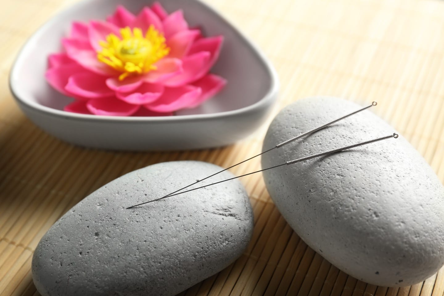 Acupuncture. Does it really work?