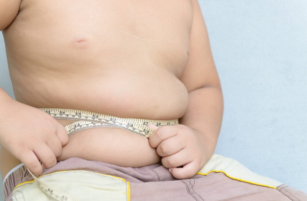 Obesity and Epigenetics