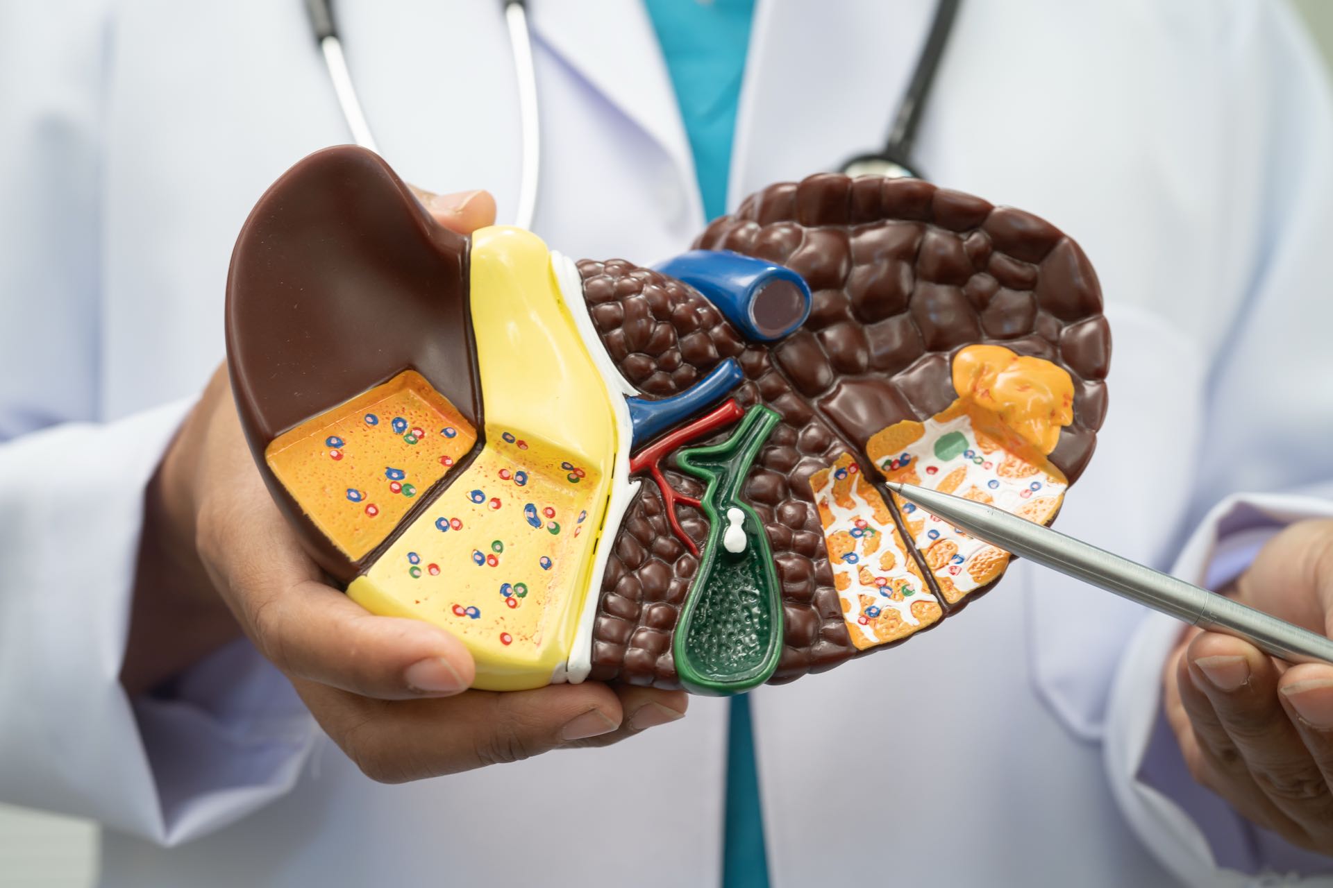 Feature Article: Fatty liver disease: what it is and why it matters