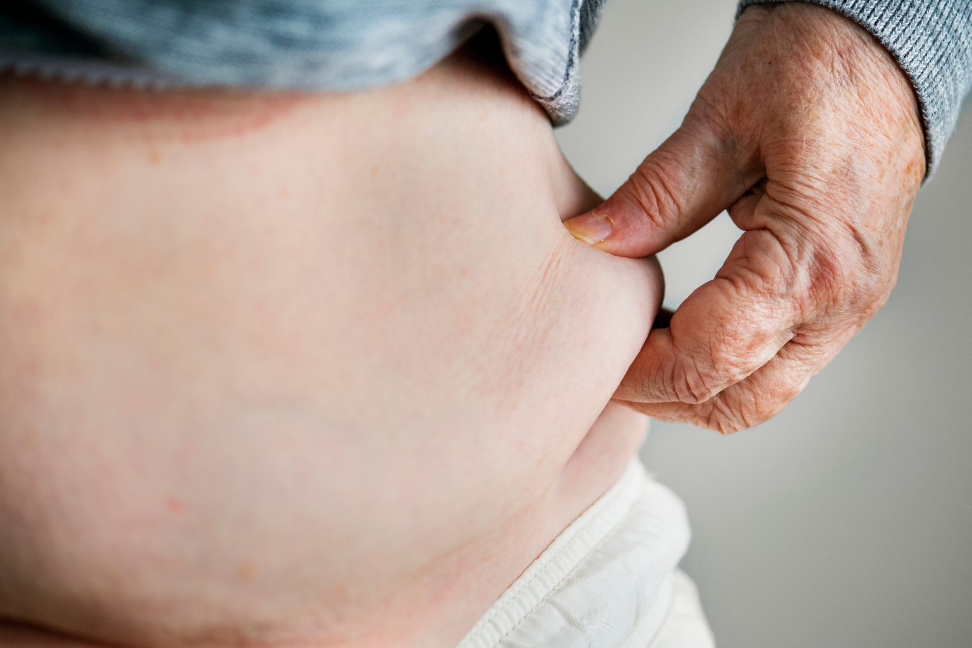 Managing Metabolic Syndrome with Lifestyle Changes